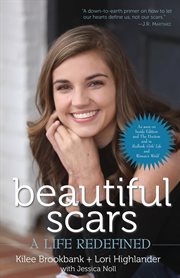 Beautiful scars : a life redefined cover image