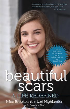 Cover image for Beautiful Scars