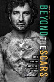 Beyond the Scars : Life is Defined by Who You Are, Not Your Circumstances cover image