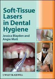 Soft-Tissue Lasers in Dental Hygiene cover image