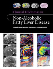 Clinical Dilemmas in Non-Alcoholic Fatty Liver Disease cover image