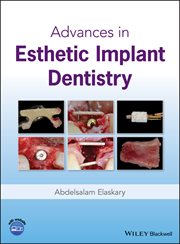Advances in Esthetic Implant Dentistry cover image