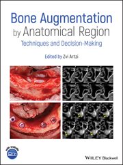 Bone Augmentation by Anatomical Region : Techniques and Decision-Making cover image