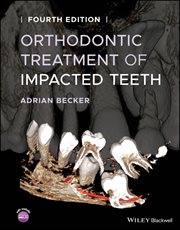 Orthodontic Treatment of Impacted Teeth cover image