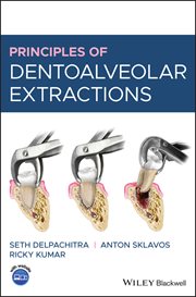 Principles of Dentoalveolar Extractions cover image