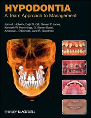 Hypodontia : A Team Approach to Management cover image
