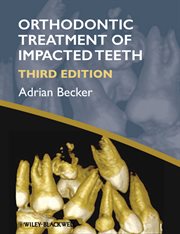 Orthodontic Treatment of Impacted Teeth cover image