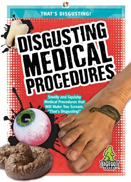Cover image for Disgusting Medical Procedures