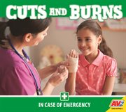 Cuts and burns cover image