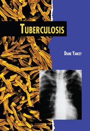 Tuberculosis cover image