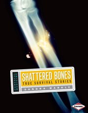 Shattered bones: true survival stories cover image