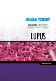 Lupus cover image