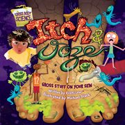 Itch & ooze: gross stuff on your skin cover image