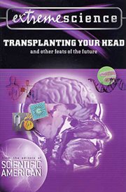 Extreme Science: Transplanting Your Head : Transplanting Your Head cover image