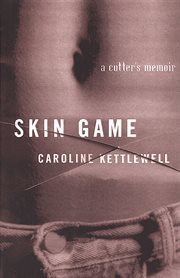 Skin Game : A Memoir cover image