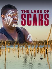 The Lake of Scars cover image