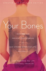 Your Bones : How You Can Prevent Osteoporosis and Have Strong Bones for Life-Naturally cover image