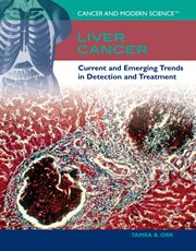 Liver cancer : current and emerging trends in detection and treatment cover image