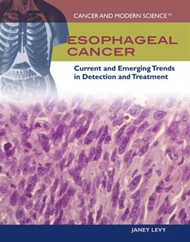 Image de couverture de Esophageal Cancer
