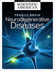 Fragile brain cover image