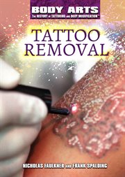 Tattoo removal cover image