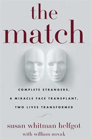 The Match : Complete Strangers, a Miracle Face Transplant, Two Lives Transformed cover image