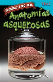 Incre̕ble pero real: anatom̕a gruesa. (Strange but True: Gross Anatomy) (Spanish Version) cover image