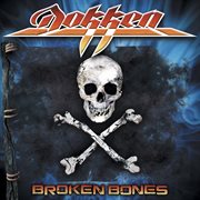 Broken bones (unbroken edition) cover image