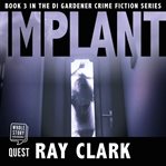 Implant cover image